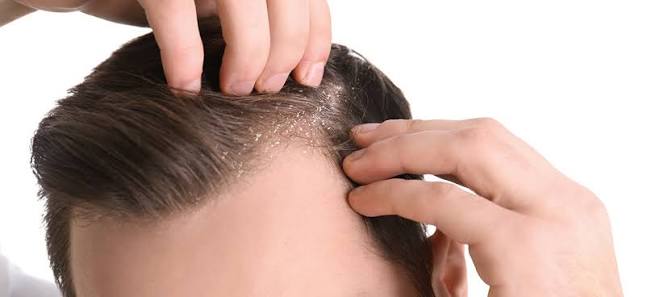 Elements Wellness Anti-Dandruff Shampoo (200ml)