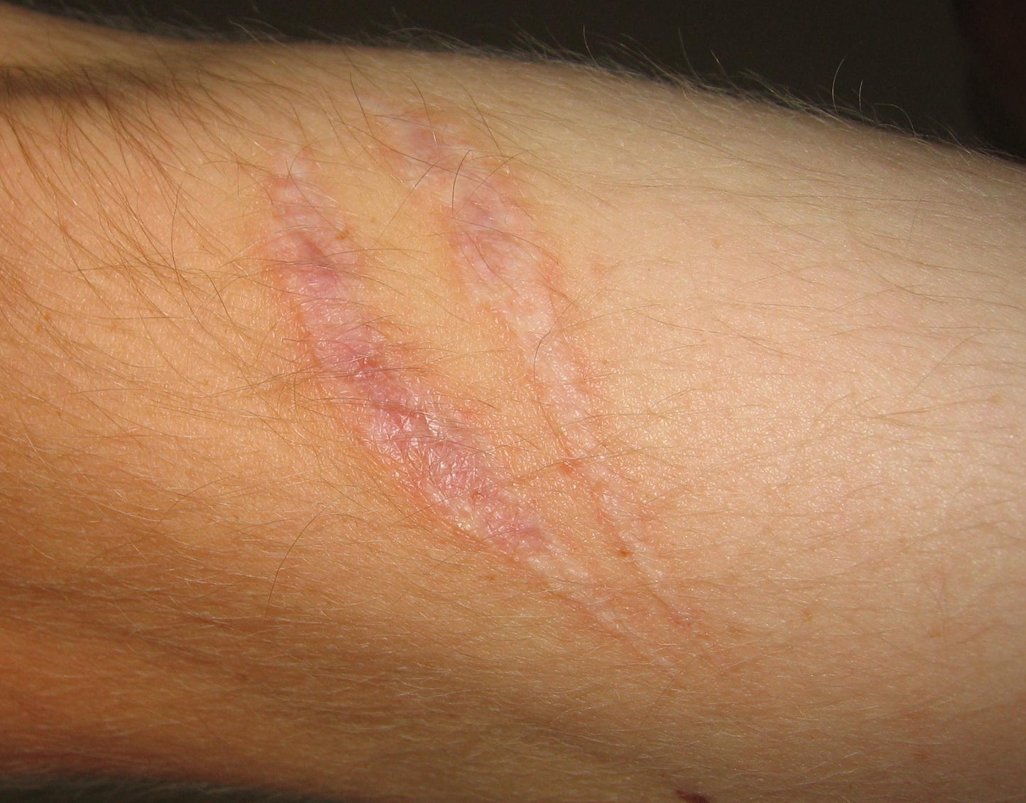 Elements Wellness Wound Healing Cream (25g)