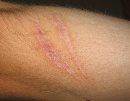 Elements Wellness Wound Healing Cream (25g)